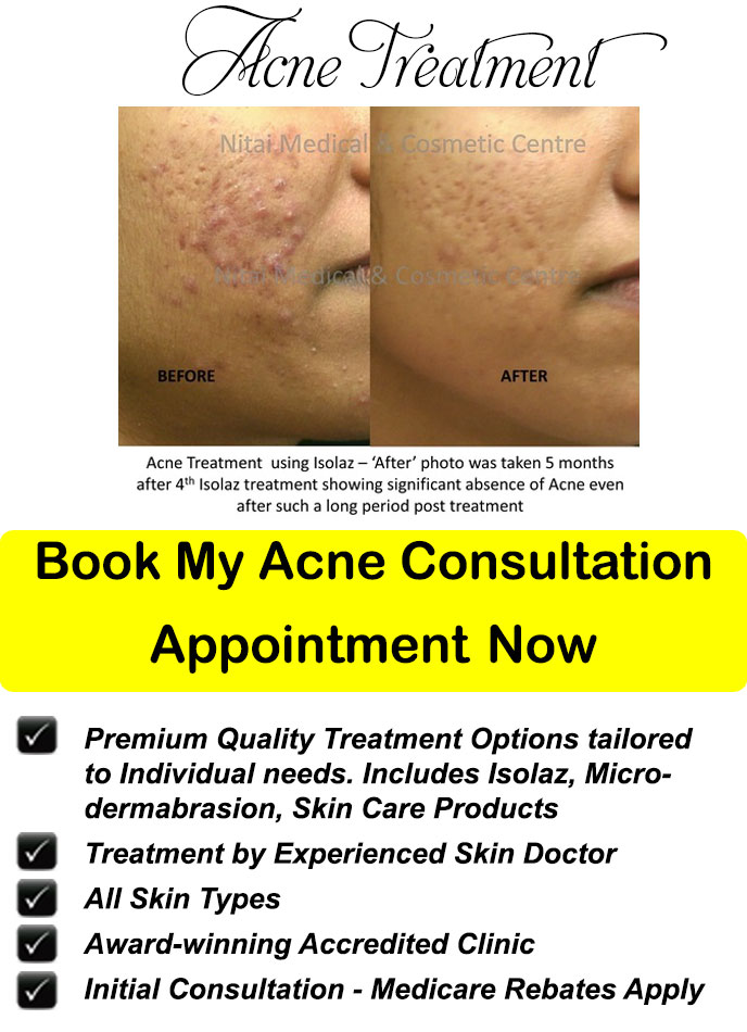 Appointment for Acne Treatment